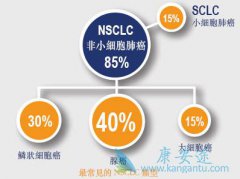 ���䲢����Ӱ�������Сϸ���ΰ����߽��ܱ�׼�Ż��Ƶ�Ч��