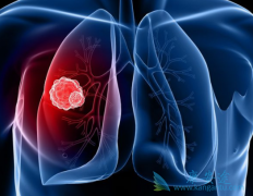 ��ϣ����9291����Էΰ�egfr�е��ҩ����Ч��ô����