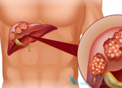 �����þ޴�ĸ������Ѿ��ǹ�ʱ���Ҹε����Ʒ���