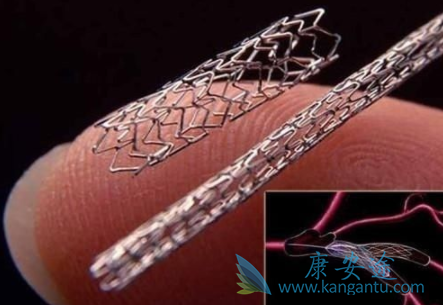 心血管支架 心血管支架