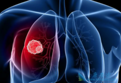 ��һ��EGFRTKI�������ᣨNazartinib�����Ʒΰ����ߵ���Ч��ô����