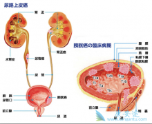 ������ҩvofatamab����������·��Ƥ�����ߵ���Ч��ô����