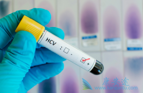 丙肝病症状 丙肝病症状