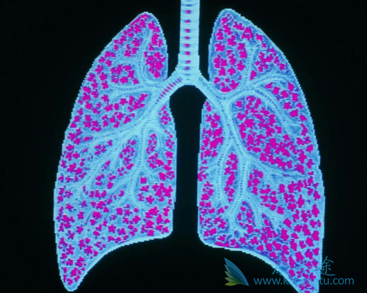 间质性肺炎 间质性肺炎