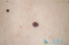 ���ڼ�⵽�ĺ�ɫ��������ͨ���������Ƶ����������ʸߴ�99��