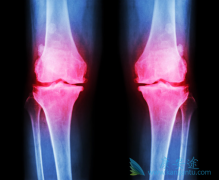 ���������Լ������԰�Ѫ����