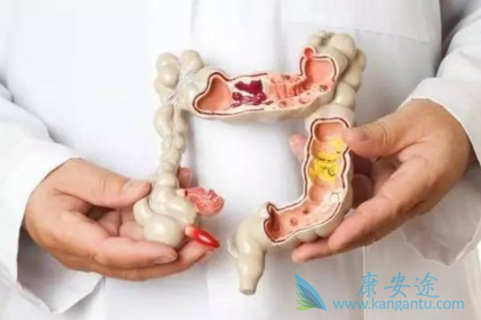 结肠癌术后能活多久 结肠癌术后能活多久