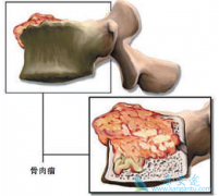 ����ҩ���ȿɽ�����������Զ��ת�Ʒ��ս���һ��