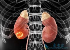 ���ѡ������������һ�����ƣ��ð������ƻ����������ƣ�