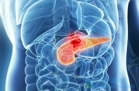 胰腺癌能活多久 胰腺癌能活多久