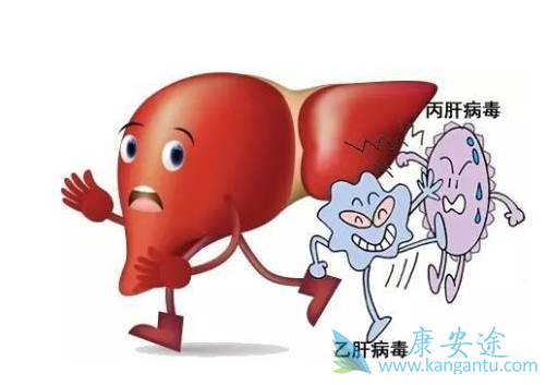 急性丙肝症状 急性丙肝症状