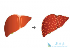 �Ҹλ�����Ҫ�Ա���ҩ�𣿸ι���������ʱ����Ҫ������