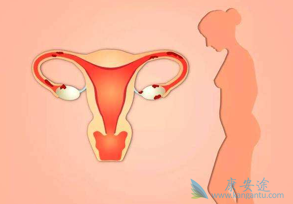 子宫癌治疗 子宫癌治疗