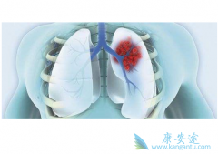 ��������/�����������ӳ�­���޽�չ��������