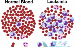 ��ͯ���ϼ�����ϵ��Ѫ��һ������Щ֢״���֣�