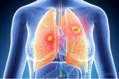 ת���Էΰ�ͨ������Щ֢״���֣�