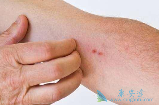 多吉美副作用 多吉美副作用