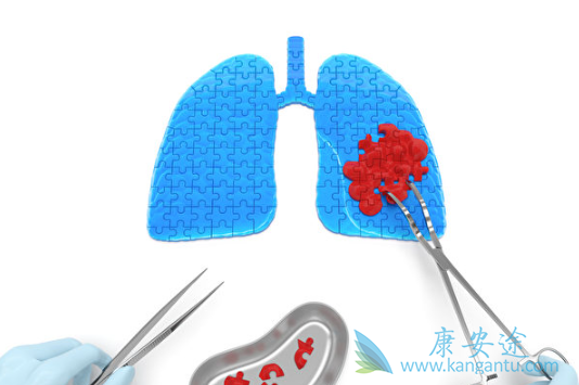 安罗替尼 安罗替尼