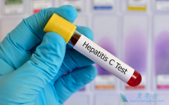 ���ο������Բ���һ��˵������Ⱦ�������Ա��͸���