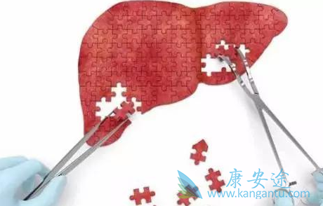 丙肝传播途径 丙肝传播途径