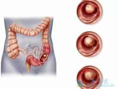 ��ֱ����ͨ��������Щ����֢״��