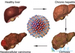 ���ε�Σ������Ҫ��������Щ���棿