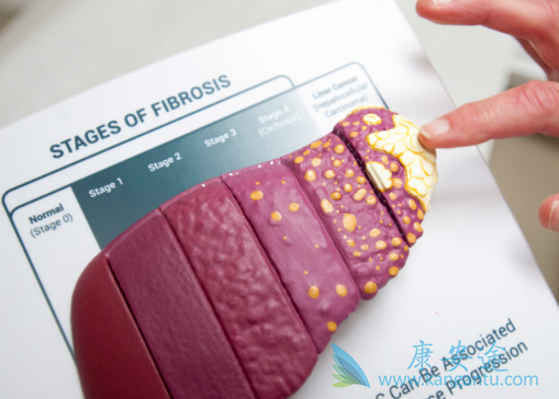 丙肝的传染 丙肝的传染