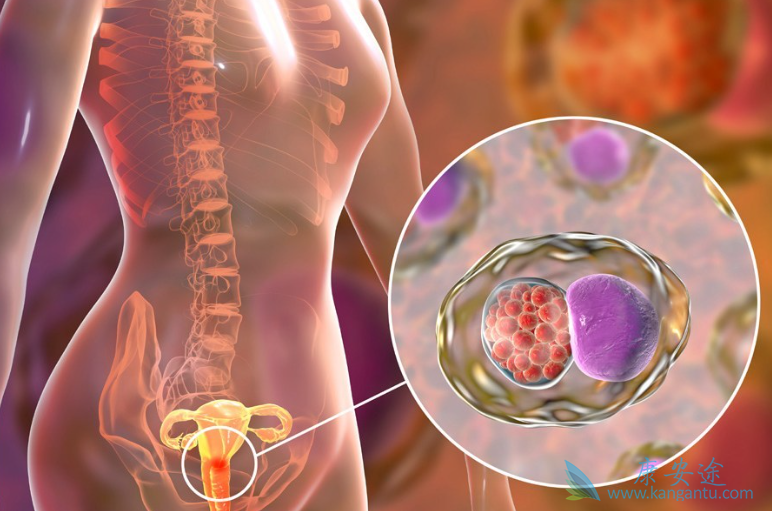 宫颈鳞癌 宫颈鳞癌