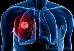 ������ΰ�����֢״�������ģ���μ��ٷΰ����������أ�