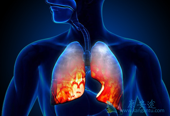 肺癌鳞癌 肺癌鳞癌