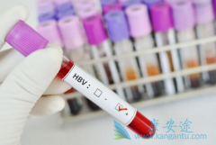 �Ҹα��濹�������Ƿ�˵���Ѿ�����Ⱦ�Ҹβ�����