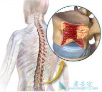 �ٴ��϶෢�Թ�������֢״����ͨ������Щ��