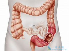 ��������������BRAF���Ƽ��������ƽ�ֱ������