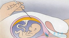 ������HBV���߲����ܲ��ܽ��в��飿