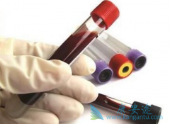 ���β�����������1000����/ml�Ƿ���Ҫ���������ƣ�