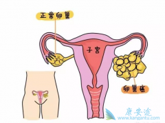 ��ͨŮ����η����ѳ���������֢״��