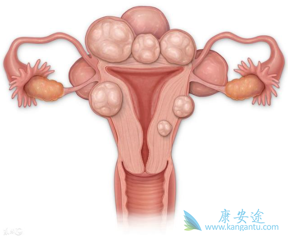 宫颈癌症状 宫颈癌症状