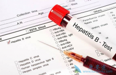 �Ҹ�dnaŨ��Խ��˵���Ҹβ���񻯵�Խ������