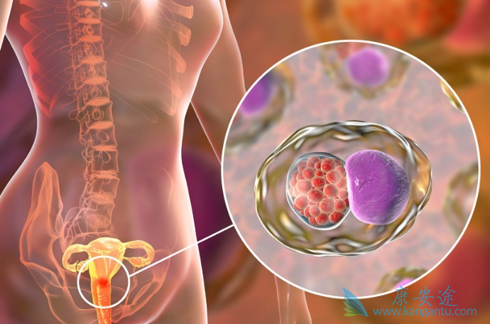 宫颈癌晚期能活多久 宫颈癌晚期能活多久