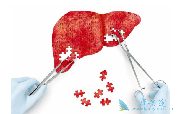 慢性乙肝 慢性乙肝