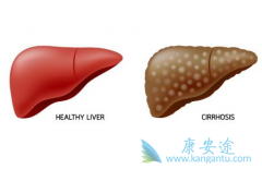 Ԥ�������Ҹζ�������Ҫ����ЩԤ��������