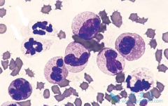 ���������쳣�ۺ�֢���Ʒ�������Щ��