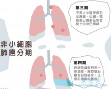 �����������Ʒ�Сϸ���ΰ����ߵ���Ч��ô����