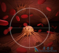 ��֢�ᴫȾ����ʹ����Ҫ�İ�֢����֢״֮һ