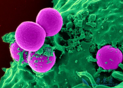 ���谩������Щ���ͣ���Ѫ�����ڹ��谩��