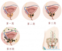 ǰ���ٰ�������ʲô���ã�ǰ���ٰ���������Щ��