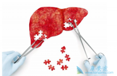 �Ҹο����鷢���Ҹα��濹ԭ������ô�죿