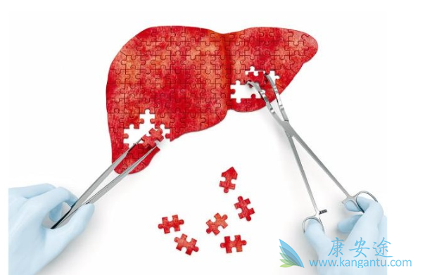 乙肝症状 乙肝症状