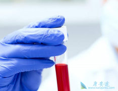 ���͸��ױ��濹������ô�����ģ���ʲô���ã�