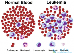 ��Ѫ�����κ�����ҩ�ڼ�Ӧע��ʲô��